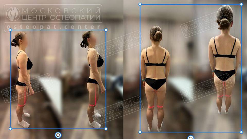 Когда отголоски старой травмы мешают двигаться Когда отголоски старой травмы мешают двигаться