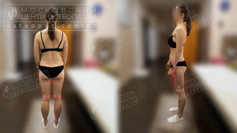 Когда отголоски старой травмы мешают двигаться Когда отголоски старой травмы мешают двигаться