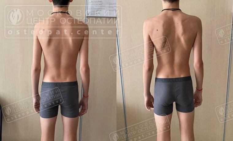 Прошли боли в спине